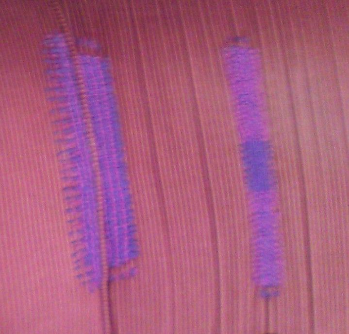 My project for course: Visible Mending: Colorful Knitwear Repair 8