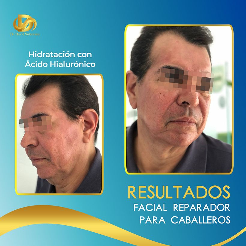 Proyecto de Redes Sociales - Diseño Gráfico - Medicina Estética 5