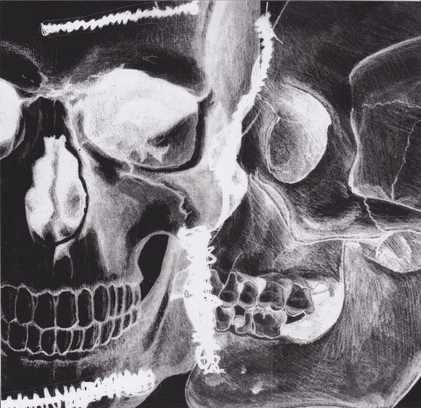 Art! Project: Arranz - Bravo 4