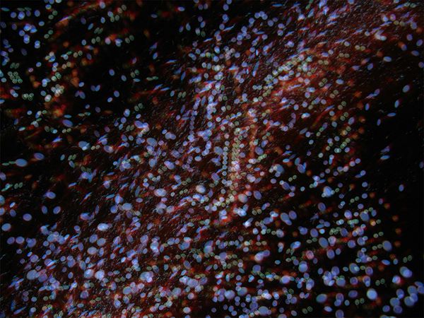 DISTANT GALAXIES 5