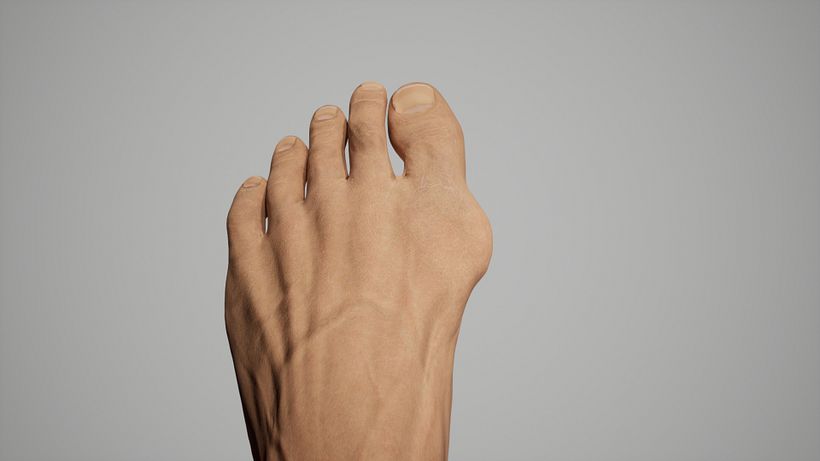 simulación 3D operación medica  4