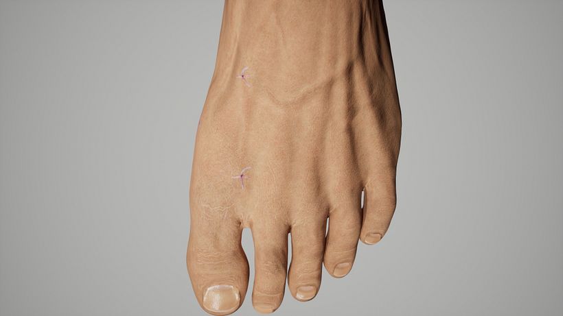 simulación 3D operación medica  9