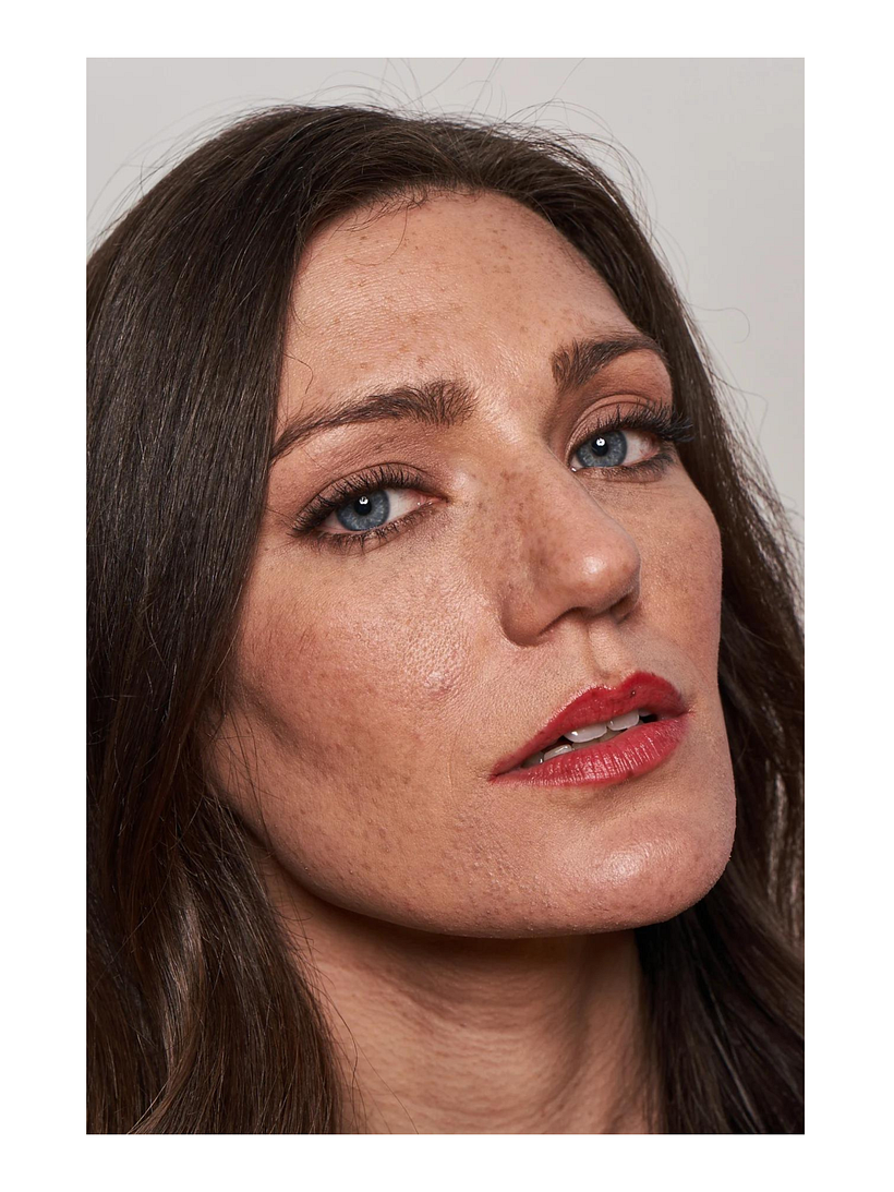 The light creates shadows under the most prominent features.