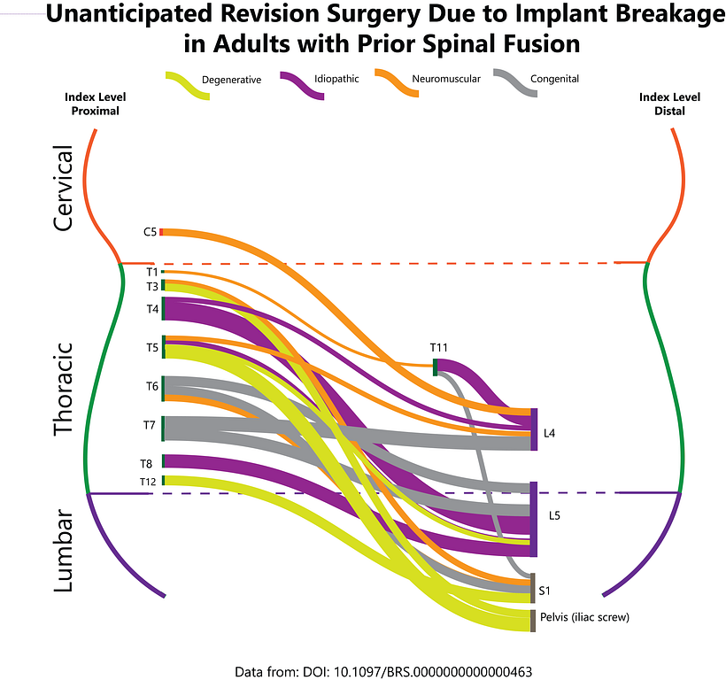 Tracking spinal revision surgery 1