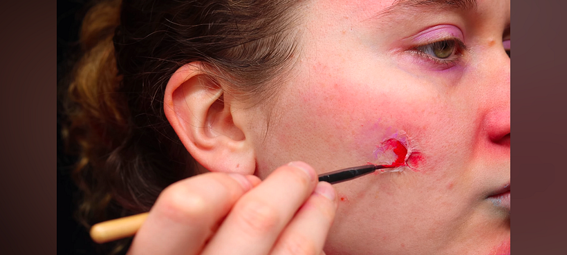 Adding red to the wounds.