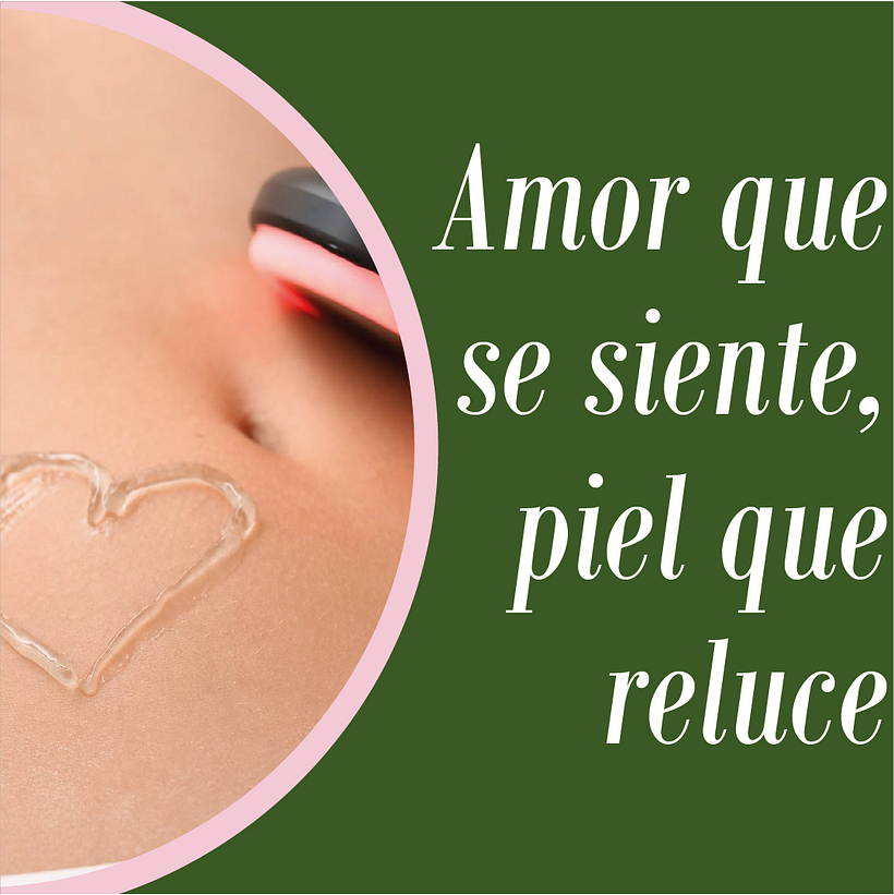 Post 4