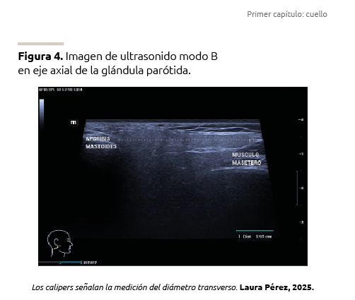 Aplicación práctica en un proyecto real 1