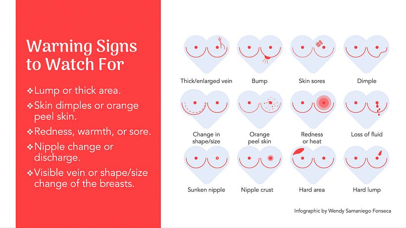 Be Breast Aware – Small Checks, Big Difference 4
