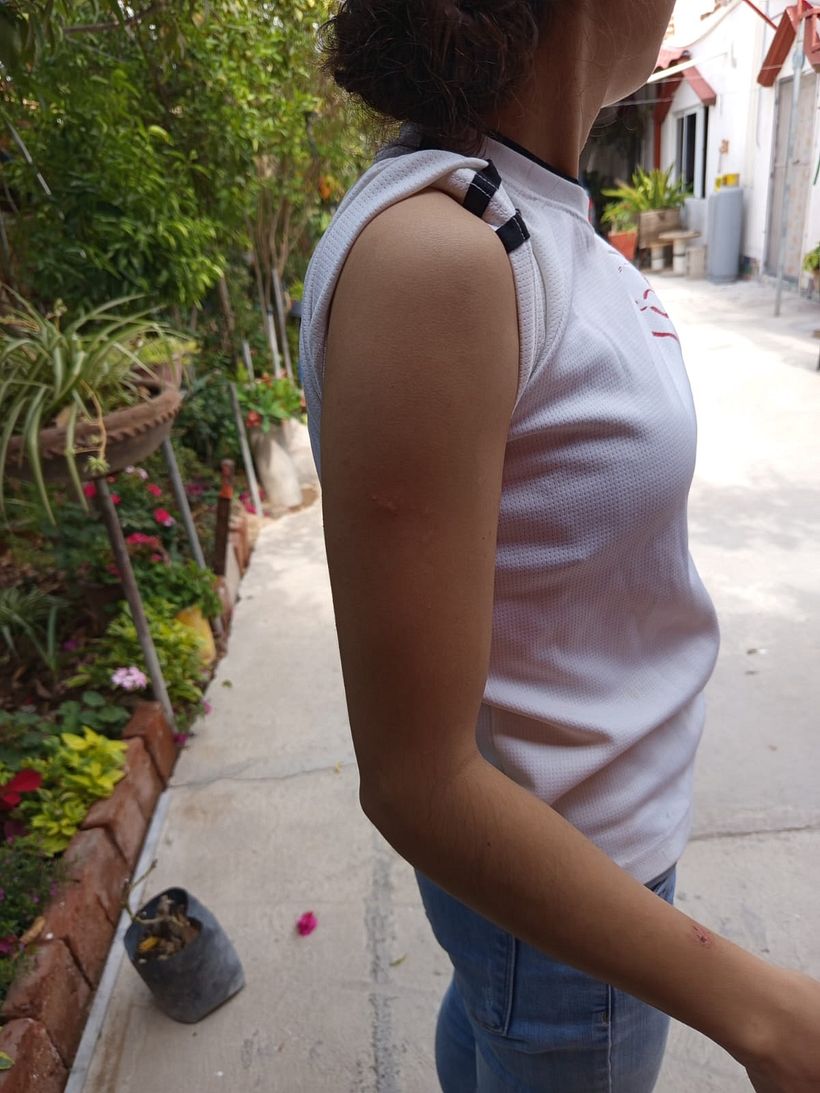 Proyecto de compocision en el cuerpo  1